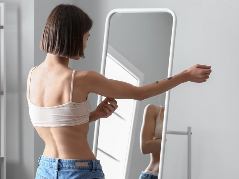 Ljudje z anoreksijo imajo zelo nizko telesno težo